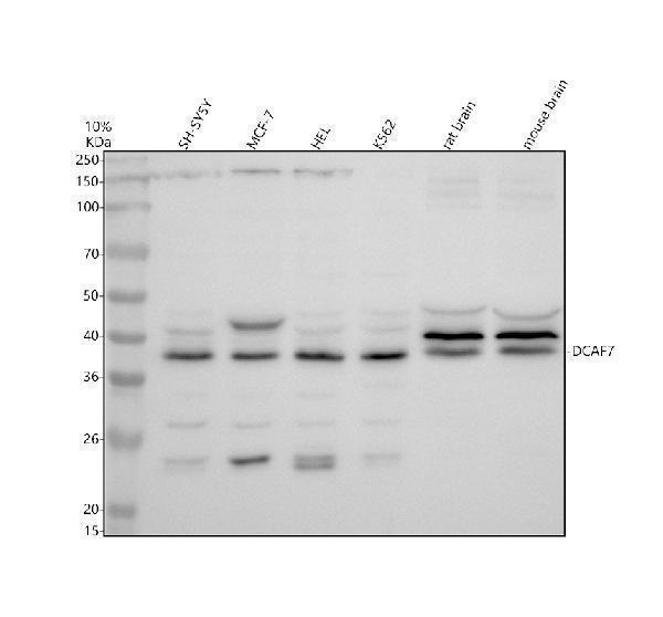 Western blot analysis of DCAF7 using anti-DCAF7 antibody (A08577-1)