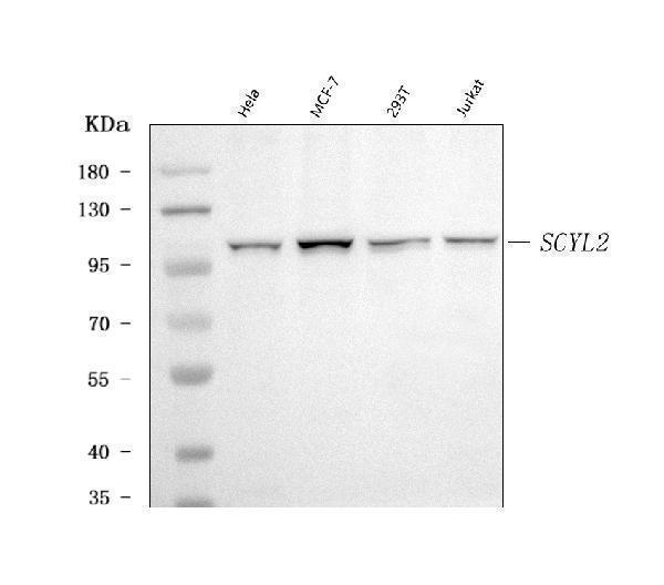  Western blot analysis of SCYL2 using anti-SCYL2 antibody (A08578-1)
