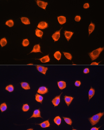 a08578 scyl2 primary antiboties if testing 2