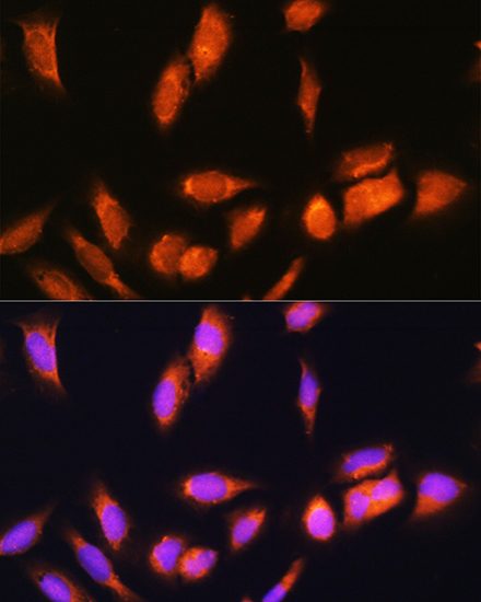 a08578 scyl2 primary antiboties if testing 3