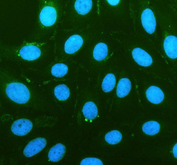 a08579 1 slc13a3 primary antibodies if testing 1