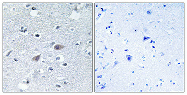 a08580 1 arsi primary antibodyes ihc testing 2