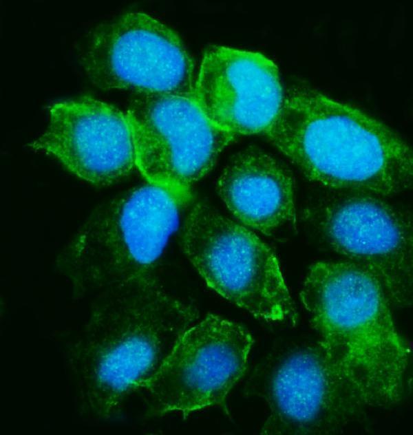 a08583 2 yars primary antibodies if testing 2