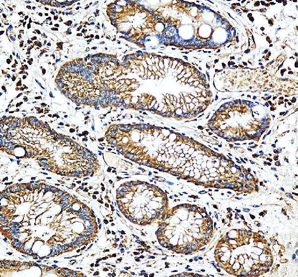 a08583 2 yars primary antibodies ihc testing 1