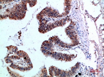 a08583 yars primary antibodies ihc testing 3