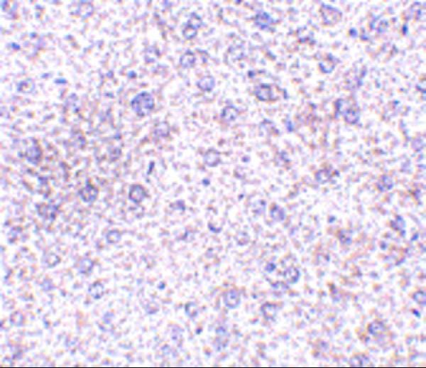 Immunohistochemistry of TEM7 in mouse liver tissue with TEM7 antibody at 2