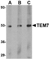 Western blot analysis of TEM7 in human liver tissue lysate with TEM7 antibody at (A) 0