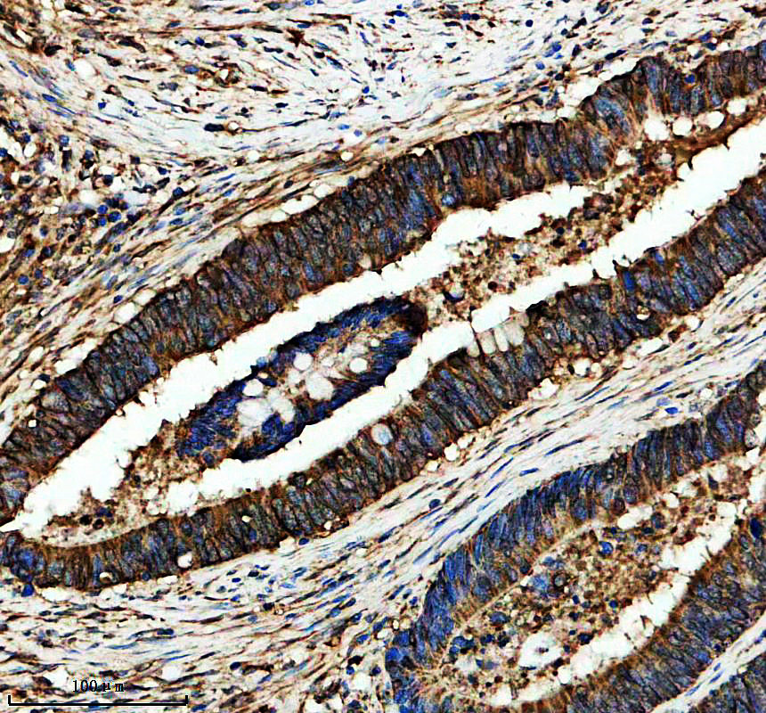 IHC analysis of LARP4 using anti-LARP4 antibody (A08588-1)