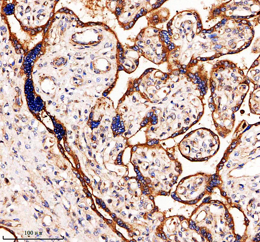 IHC analysis of LARP4 using anti-LARP4 antibody (A08588-1)