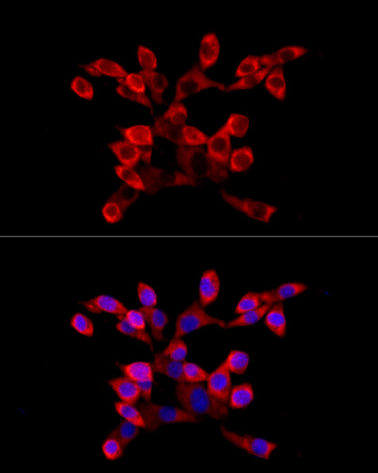 a08588 larp4 primary antiboties if testing 2