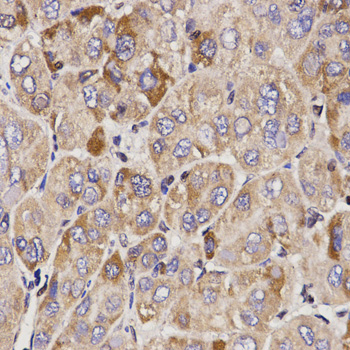 a08589 gas2 primary antiboties ihc testing 2