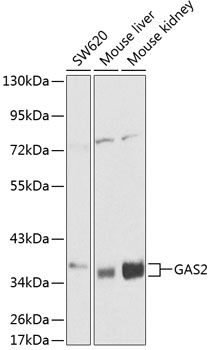 a08589 gas2 primary antiboties wb testing 1