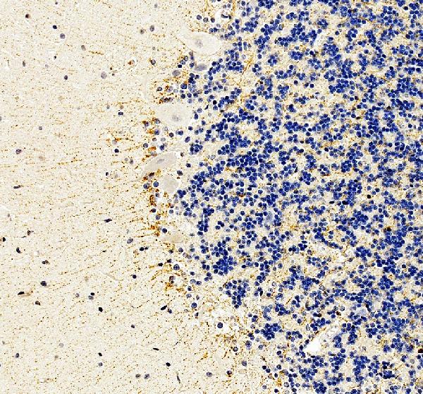 a08598 2 htr1e primary antibodies ihc testing 1