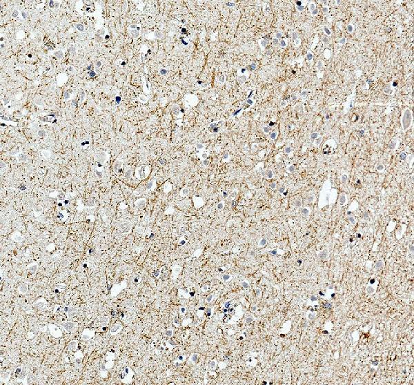 a08598 2 htr1e primary antibodies ihc testing 2