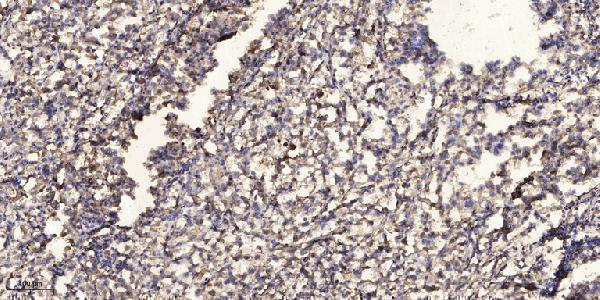 a08598 htr1e primary antibodies ihc testing 1