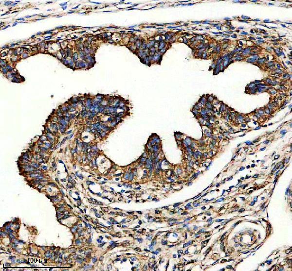 a08600 1 slco4a1 primary antibodies ihc testing 1
