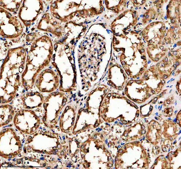 a08600 1 slco4a1 primary antibodies ihc testing 2