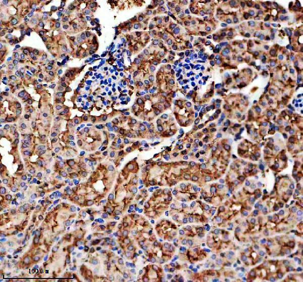 a08600 1 slco4a1 primary antibodies ihc testing 3
