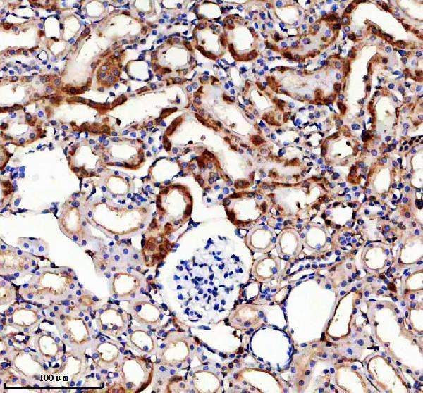 a08600 1 slco4a1 primary antibodies ihc testing 4