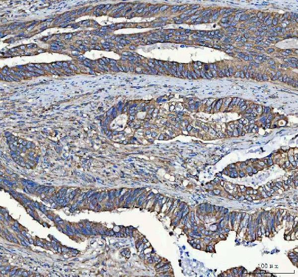 a08602 mydgf primary antibodies ihc testing 3