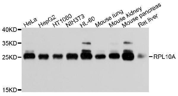 Western blot analysis of extracts of various cells, using RPL10A antibody