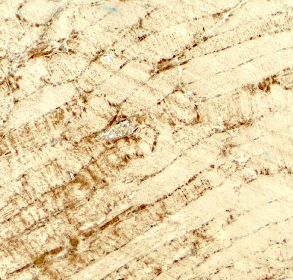 a08607 c5orf20 primary antibodies ihc testing 2