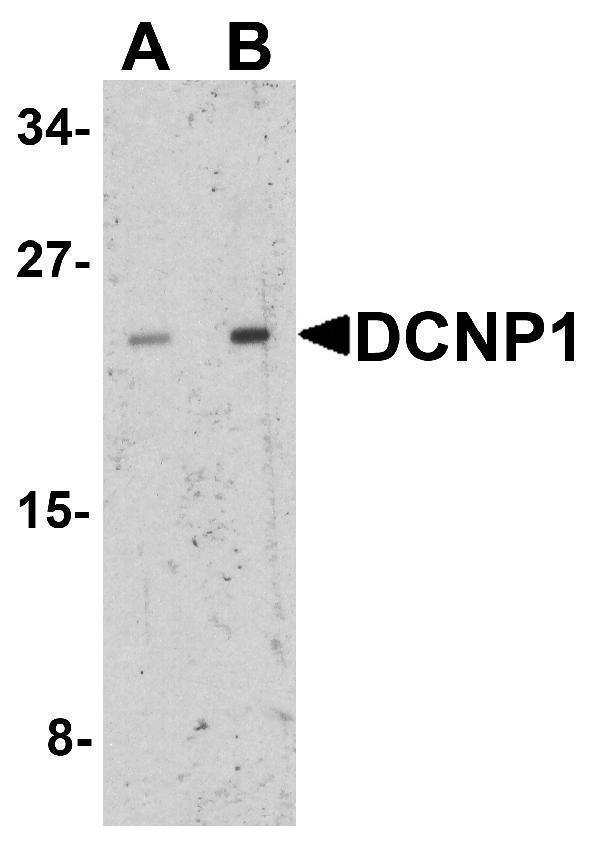 a08607 c5orf20 primary antibodies wb testing 1