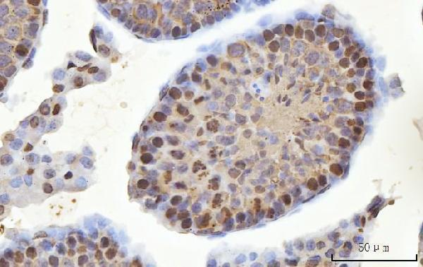 IHC analysis of MSY2/YBOX2/YBX2 using anti-MSY2/YBOX2/YBX2 antibody (A08610-2)