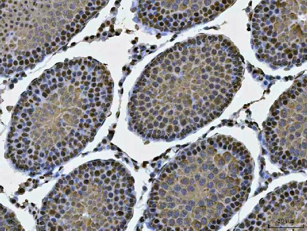  IHC analysis of MSY2/YBOX2/YBX2 using anti-MSY2/YBOX2/YBX2 antibody (A08610-2)
