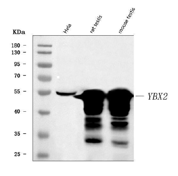  Western blot analysis of MSY2/YBOX2/YBX2 using anti-MSY2/YBOX2/YBX2 antibody (A08610-2)