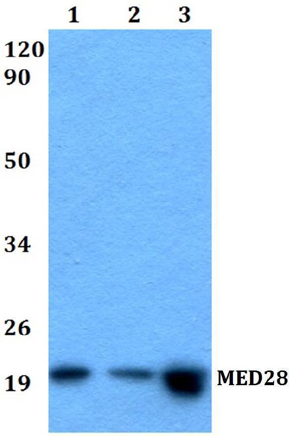 Western blot (WB) analysis of MED28 polyclonal antibody at 1:500 dilution
Lane1:HEK293Twhole cell lysate
Lane2:Raw264
