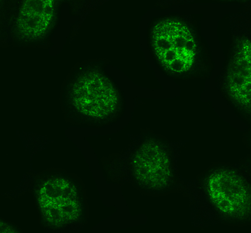 IF analysis of MED28 using anti-MED28 antibody (A08611-2)