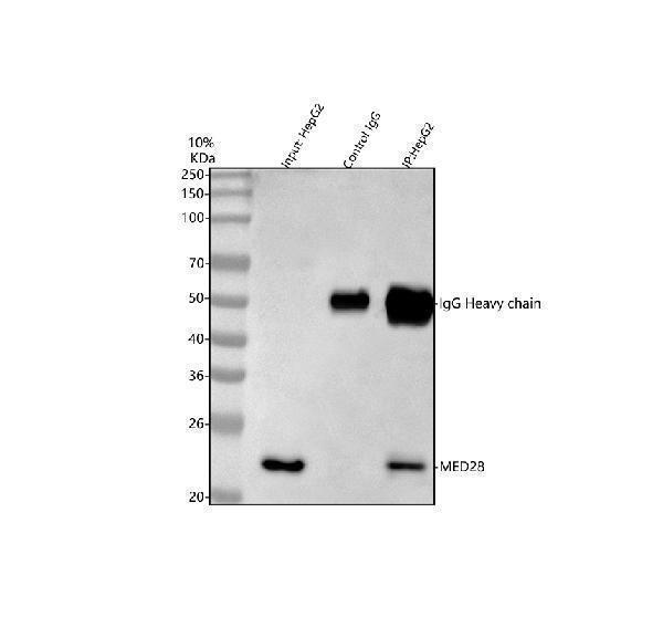  Immunoprecipitating MED28 in HepG2 whole cell lysate