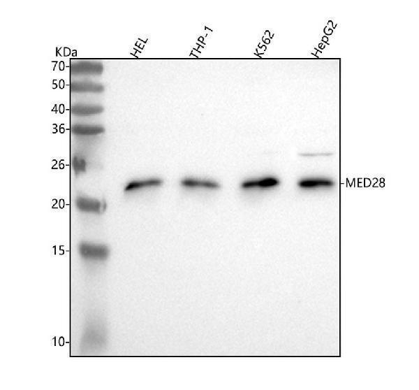  Western blot analysis of MED28 using anti-MED28 antibody (A08611-2)