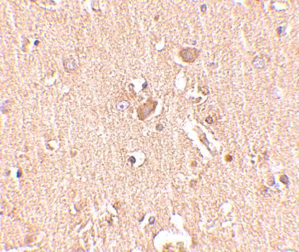 Immunohistochemistry of MED28 in human brain tissue with MED28 antibody at 2