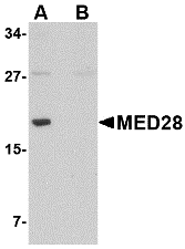 Western blot analysis of MED28 in human brain tissue lysate with MED28 antibody at 1 μg/mL in (A) the absence and (B) the presence of blocking peptide