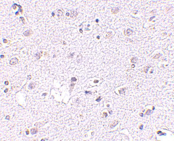 a08612 1 cers5 primary antibodies ihc testing 2