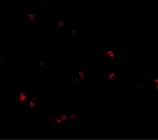 Immunofluorescence of LASS5 in human brain tissue with LASS5 antibody at 20 μg/mL