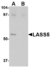 Western blot analysis of LASS5 in SK-N-SH lysate with LASS5 antibody at 1 μg/mL in the (A) absence and (B) presence of blocking peptide