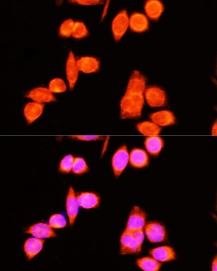a08613 dnajc19 primary antiboties if testing 2