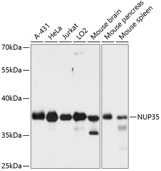 Western blot analysis of extracts of various cell lines, using NUP35 antibody  at 1:3000 dilution