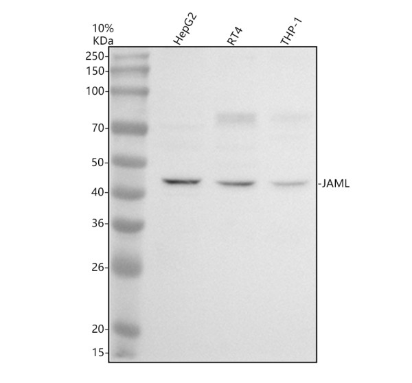 Western blot analysis of JAML using anti-JAML antibody (A08615-1)