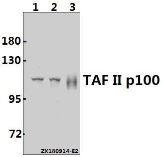 Western blot (WB) analysis of TAF II p100 (G411) pAb at 1:500 dilution
Lane1:HCT116 whole cell lysate(40ug)
Lane2:A2780 whole cell lysate(40ug)
Lane3:The Lung tissue lysate of Rat(20ug)