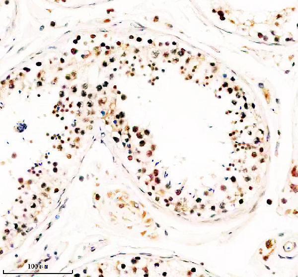 IHC analysis of TAF5 using anti-TAF5 antibody (A08618-2)
