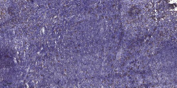 a08620 adamts17 primary antibodies ihc testing 1