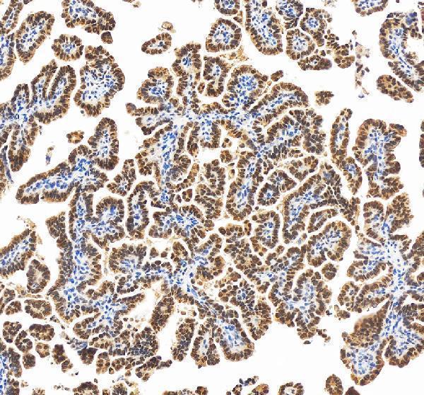 IHC analysis of RBM17 using anti-RBM17 antibody (A08621-1)