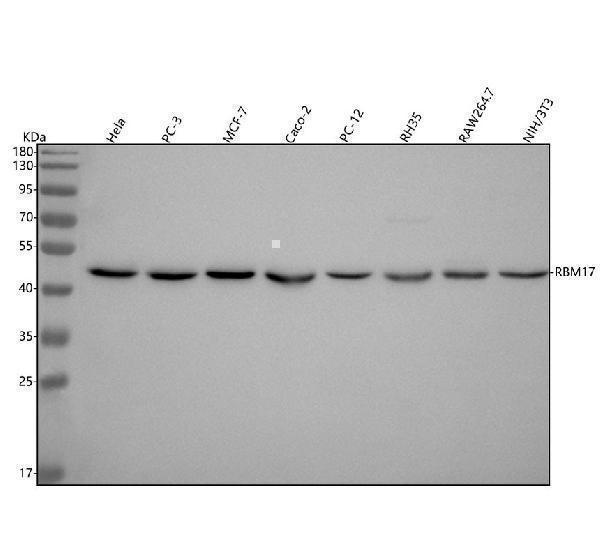  Western blot analysis of RBM17 using anti-RBM17 antibody (A08621-1)