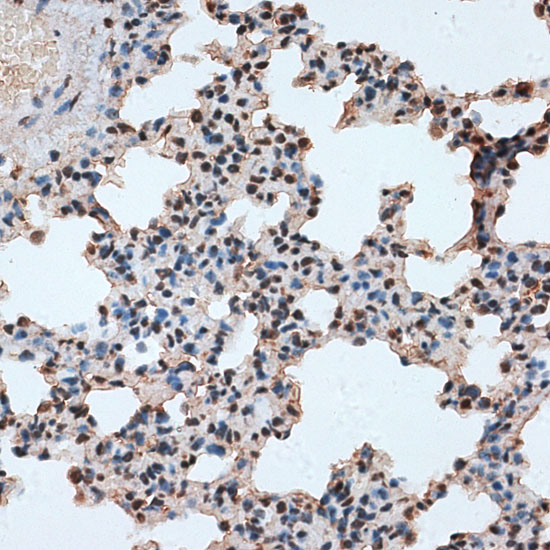 a08621 rbm17 primary antiboties ihc testing 2