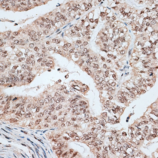 a08621 rbm17 primary antiboties ihc testing 3