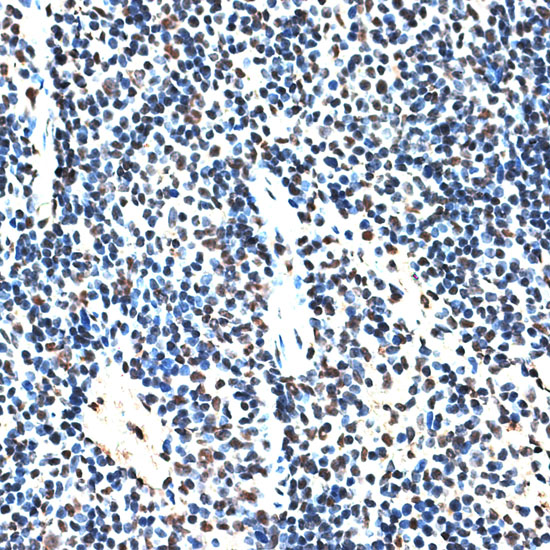 a08621 rbm17 primary antiboties ihc testing 4
